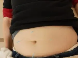 Vitaminpraxis Catrin Wehlend 11 Bauch-Akupunktur in Verbindung mit Entspannungspunkten
